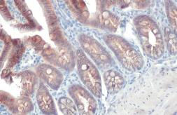 Anti-E-Cadherin antibody [HL1229] used in IHC (Paraffin sections) (IHC-P). GTX636577