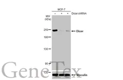 Anti-Dicer antibody [HL1232] used in Western Blot (WB). GTX636580