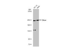 Anti-Dicer antibody [HL1232] used in Western Blot (WB). GTX636580