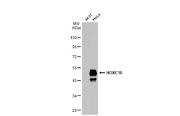 Anti-Homeobox C10 antibody [HL1234] used in Western Blot (WB). GTX636633