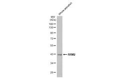 Anti-RRM2 antibody [HL1235] used in Western Blot (WB). GTX636634