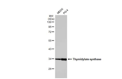 Anti-Thymidylate synthase antibody [HL1237] used in Western Blot (WB). GTX636636