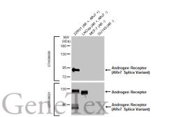 Anti-Androgen Receptor (ARv7 Splice Variant) antibody [HL1239] used in Western Blot (WB). GTX636638