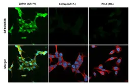 Anti-Androgen Receptor (ARv7 Splice Variant) antibody [HL1239] used in Immunocytochemistry/ Immunofluorescence (ICC/IF). GTX636638