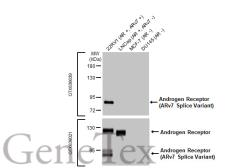 Anti-Androgen Receptor (ARv7 Splice Variant) antibody [HL1240] used in Western Blot (WB). GTX636639