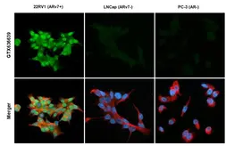 Anti-Androgen Receptor (ARv7 Splice Variant) antibody [HL1240] used in Immunocytochemistry/ Immunofluorescence (ICC/IF). GTX636639