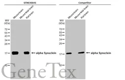 Anti-alpha Synuclein antibody [HL1242] used in Western Blot (WB). GTX636641