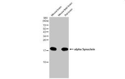Anti-alpha Synuclein antibody [HL1242] used in Western Blot (WB). GTX636641