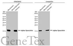 Anti-alpha Synuclein antibody [HL1243] used in Western Blot (WB). GTX636642