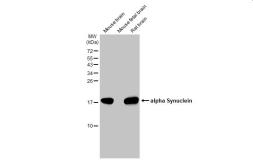 Anti-alpha Synuclein antibody [HL1243] used in Western Blot (WB). GTX636642