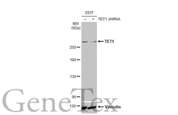Anti-TET1 antibody [GT1382] used in Western Blot (WB). GTX636643
