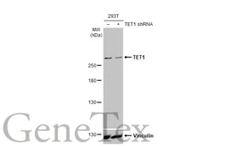 Anti-TET1 antibody [GT231] used in Western Blot (WB). GTX636644