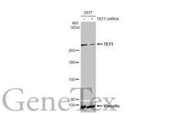 Anti-TET1 antibody [GT2457] used in Western Blot (WB). GTX636645