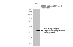 Anti-Respiratory Syncytial virus Nucleoprotein antibody [HL1245] used in Western Blot (WB). GTX636647