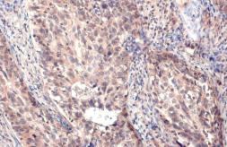 Anti-MMP1 antibody [HL1259] used in IHC (Paraffin sections) (IHC-P). GTX636661