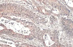 Anti-CYLD antibody [HL1260] used in IHC (Paraffin sections) (IHC-P). GTX636662