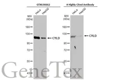 Anti-CYLD antibody [HL1260] used in Western Blot (WB). GTX636662