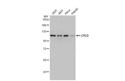 Anti-CYLD antibody [HL1261] used in Western Blot (WB). GTX636663