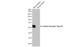 Anti-Activin Receptor Type IB antibody [HL1266] used in Western Blot (WB). GTX636668