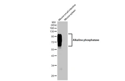 Anti-Alkaline phosphatase antibody [HL1267] used in Western Blot (WB). GTX636669