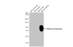 Anti-Alkaline phosphatase (intestinal) antibody [HL1268] used in Western Blot (WB). GTX636670