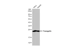 Anti-Transgelin antibody [HL1270] used in Western Blot (WB). GTX636672