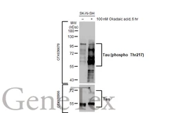 Anti-Tau (phospho Thr217) antibody [HL1276] used in Western Blot (WB). GTX636678