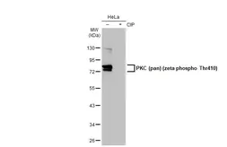Anti-PKC (pan) (zeta phospho Thr410) antibody [HL1278] used in Western Blot (WB). GTX636680