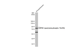 Anti-PKC (pan) (zeta phospho Thr410) antibody [HL1279] used in Western Blot (WB). GTX636681