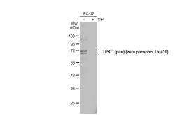 Anti-PKC (pan) (zeta phospho Thr410) antibody [HL1279] used in Western Blot (WB). GTX636681