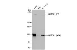 Anti-NOTCH1 antibody [HL1281] used in Western Blot (WB). GTX636683