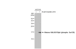 Anti-Histone H2A.XS139ph (phospho Ser139) antibody [HL1299] used in Western Blot (WB). GTX636713