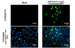 Anti-SARS-CoV-2 (COVID-19) nsp7 antibody [HL1301] used in Immunocytochemistry/ Immunofluorescence (ICC/IF). GTX636719