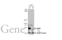 Anti-CD44 antibody [HL1306] used in Western Blot (WB). GTX636724