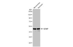 Anti-GFAP antibody [HL1307] used in Western Blot (WB). GTX636725