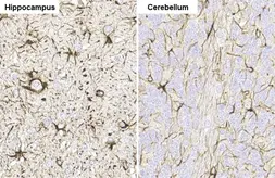 Anti-GFAP antibody [HL1307] used in IHC (Paraffin sections) (IHC-P). GTX636725