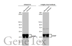 Anti-GFAP antibody [HL1307] used in Western Blot (WB). GTX636725