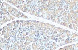Anti-Pancreatic Lipase antibody [HL1310] used in IHC (Paraffin sections) (IHC-P). GTX636728