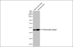 Anti-Pancreatic Lipase antibody [HL1310] used in Western Blot (WB). GTX636728
