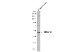 Anti-ATP6V1H antibody [HL1316] used in Western Blot (WB). GTX636734