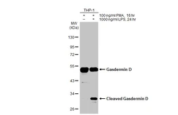Anti-Gasdermin D antibody [HL1334] used in Western Blot (WB). GTX636754