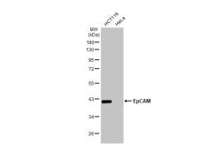 Anti-EpCAM antibody [HL1338] used in Western Blot (WB). GTX636758