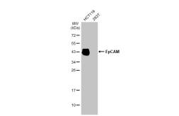 Anti-EpCAM antibody [HL1339] used in Western Blot (WB). GTX636759
