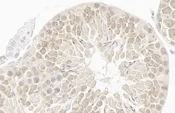 Anti-GSPT1 antibody [HL1345] used in IHC (Paraffin sections) (IHC-P). GTX636765