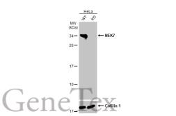 Anti-NEK7 antibody [HL1348] used in Western Blot (WB). GTX636768
