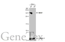 Anti-NEK7 antibody [HL1348] used in Western Blot (WB). GTX636768