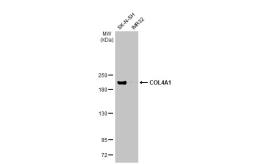 Anti-COL4A1 antibody [HL1351] used in Western Blot (WB). GTX636771