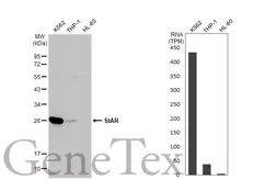 Anti-StAR antibody [HL1360] used in Western Blot (WB). GTX636800