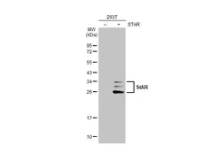 Anti-StAR antibody [HL1360] used in Western Blot (WB). GTX636800