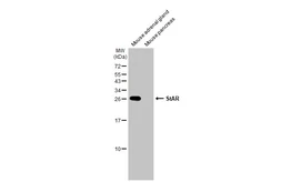 Anti-StAR antibody [HL1360] used in Western Blot (WB). GTX636800